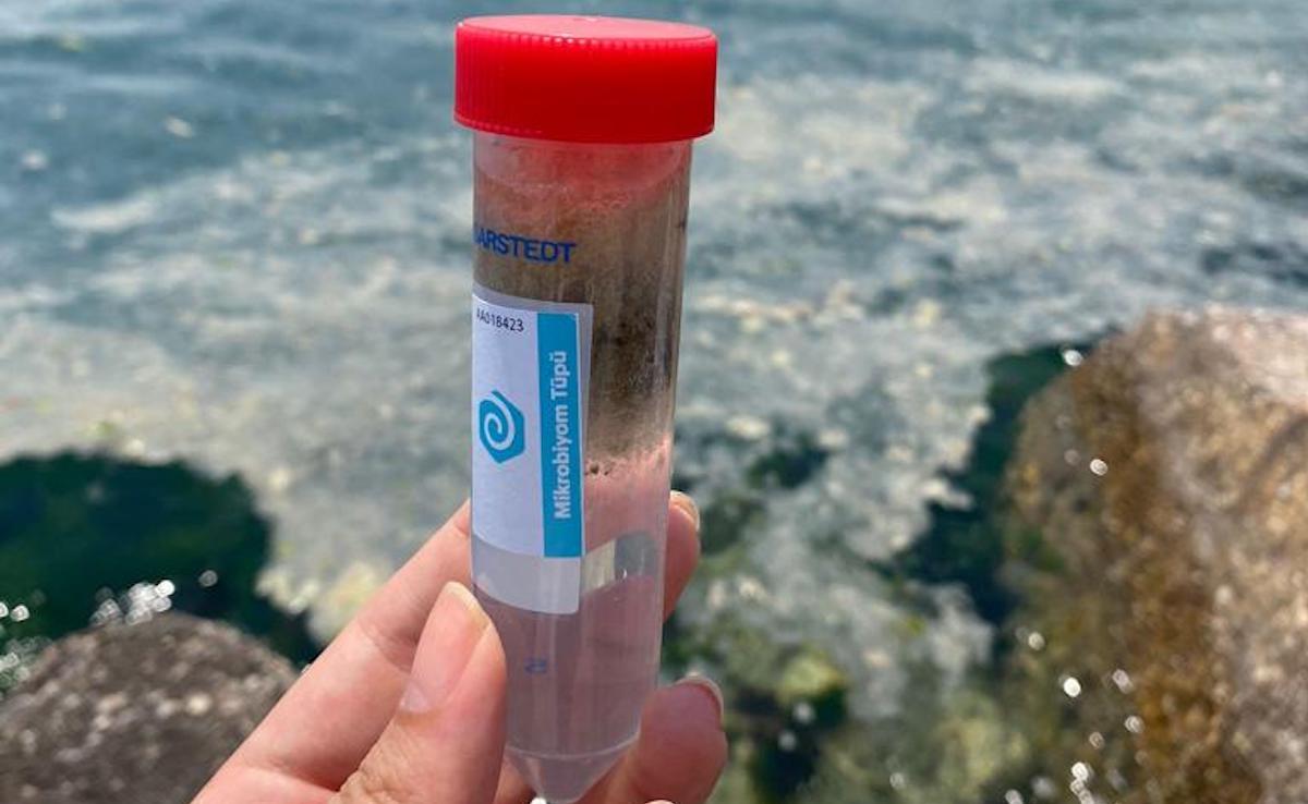 Turkish biotechnology startup will do a research on mucilage!