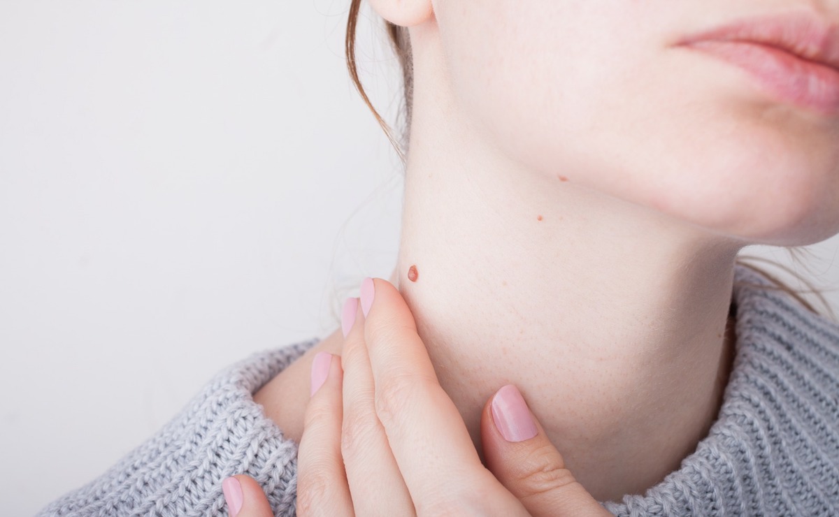 Do not try to treat warts with hearsay methods!