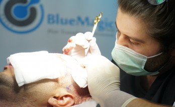 Turkey gears up in health tourism with hair transplant